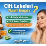 Cilt Lekeleri Nasıl Geçer? Evde Doğal Yöntemler ve Etkili Bakım Rehberi (2026)