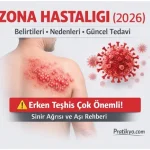Zona Hastalığı Nedir? Belirtileri, Nedenleri ve Güncel Tedavi Rehberi (2026)